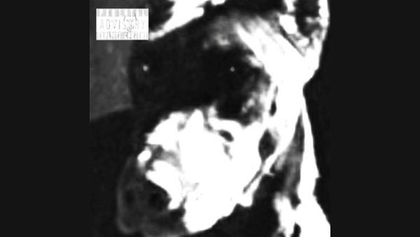 Dogfood Lyrics - untiljapan